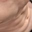 Klp333