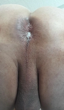 Kima