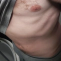UgniukasKiss