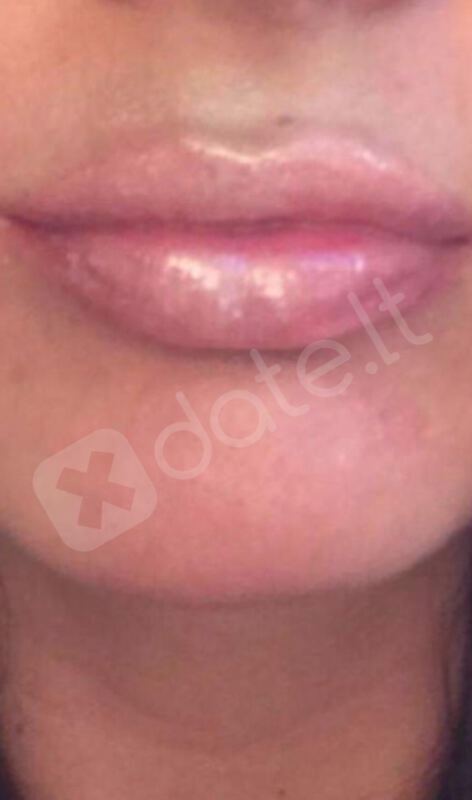Pupyte231217958