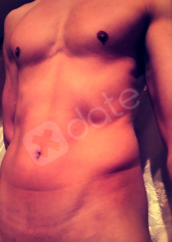 Marcas99995937579