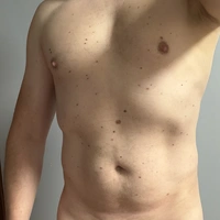xrimantasx